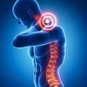 cervical-pain Cervical pain